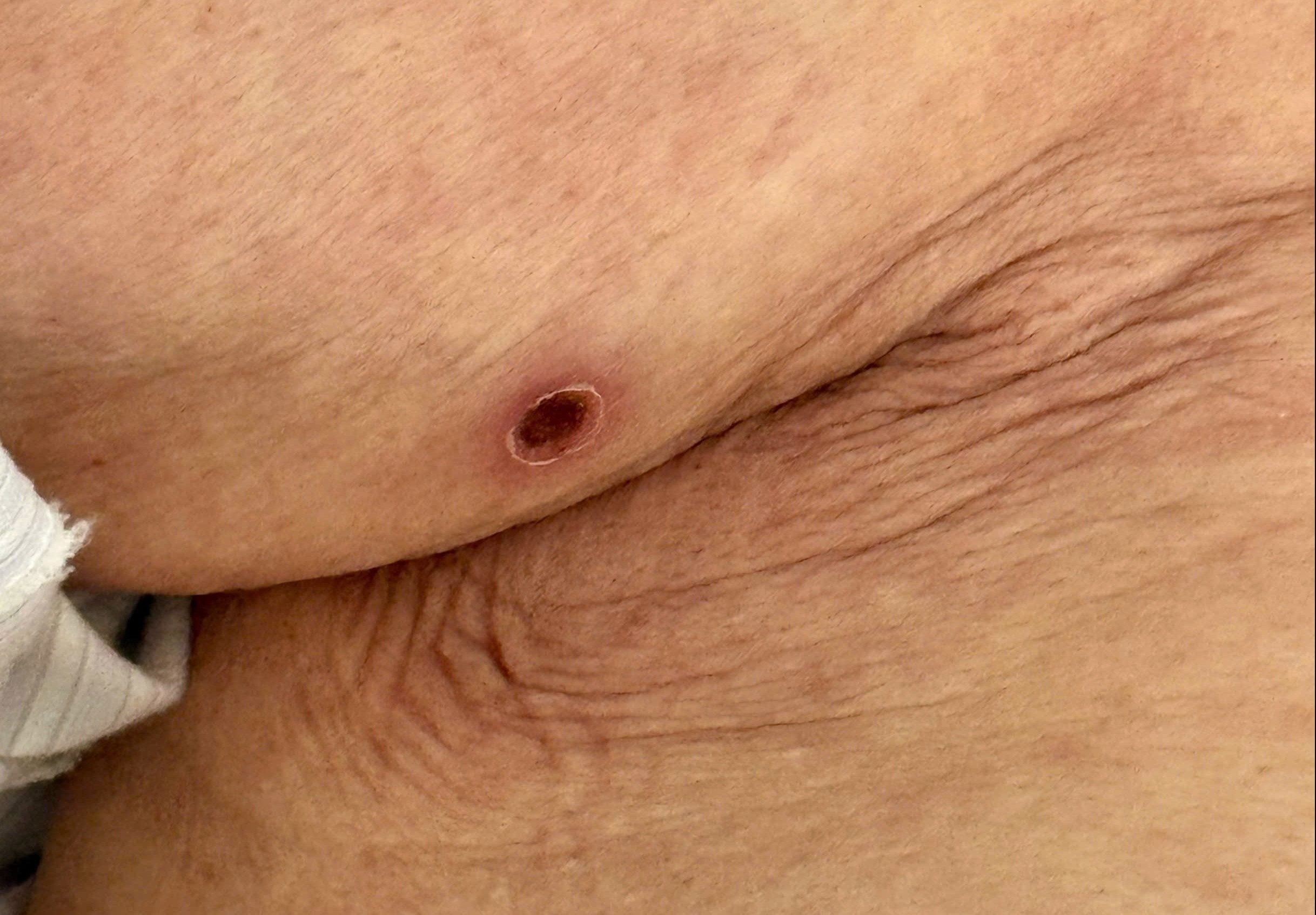 Nguy kich vi vet loet o vi tri khong ai ngo toi hinh anh