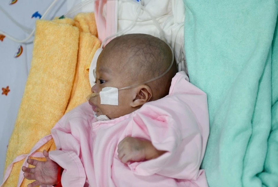 Nguyen nhan hang dau gay tu vong o tre so sinh hinh anh