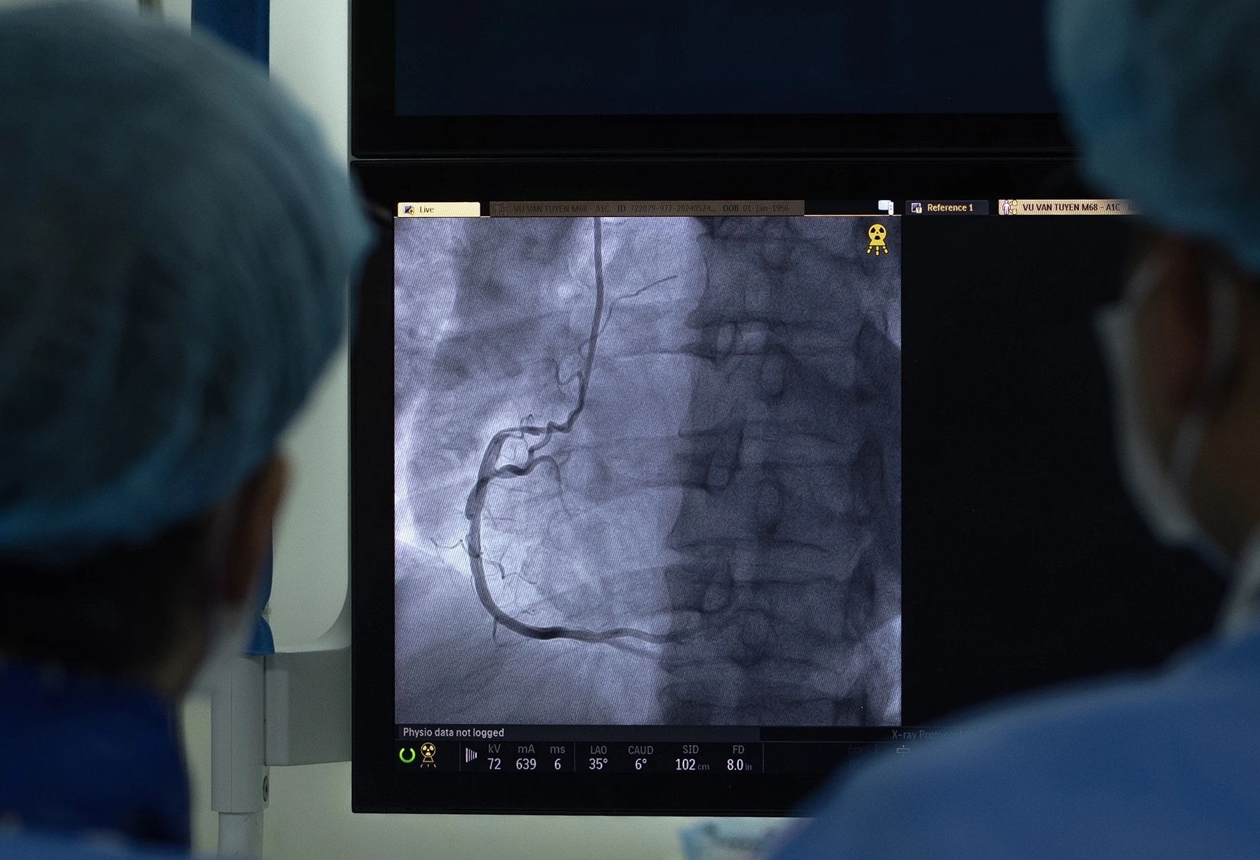 nhoi mau co tim anh 1