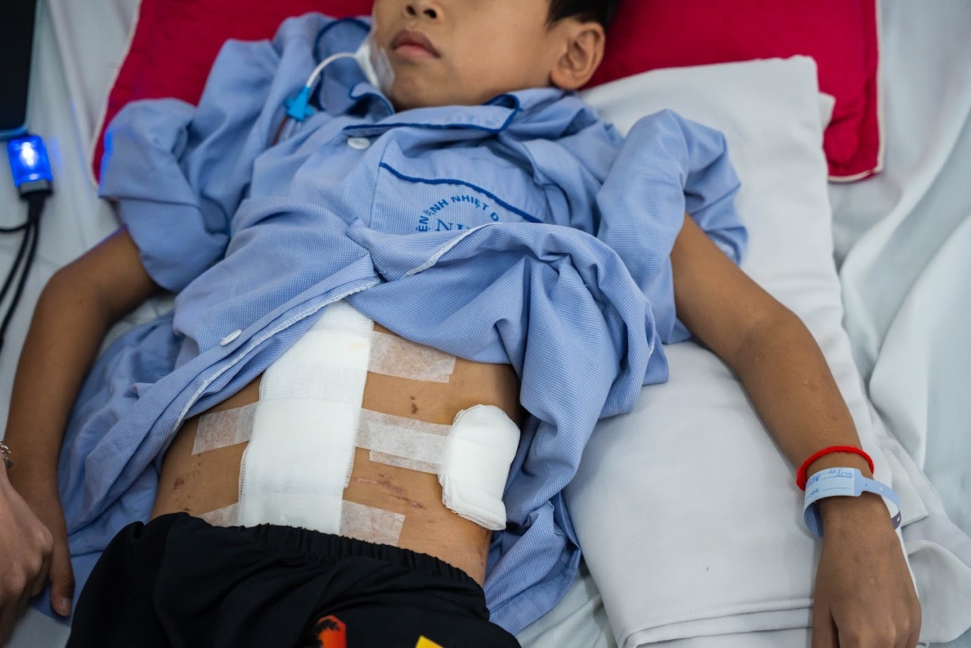 Trieu chung am tham bao hieu mac viem gan B hinh anh