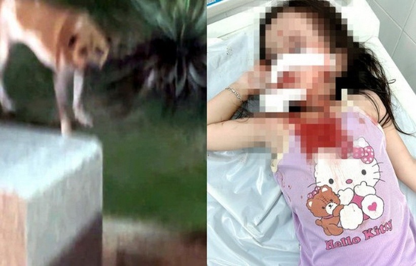 TP.HCM: Be gai bi cho tan cong, thuong tich nghiem trong vung mat hinh anh