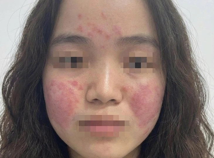 khong khi o nhiem anh 1