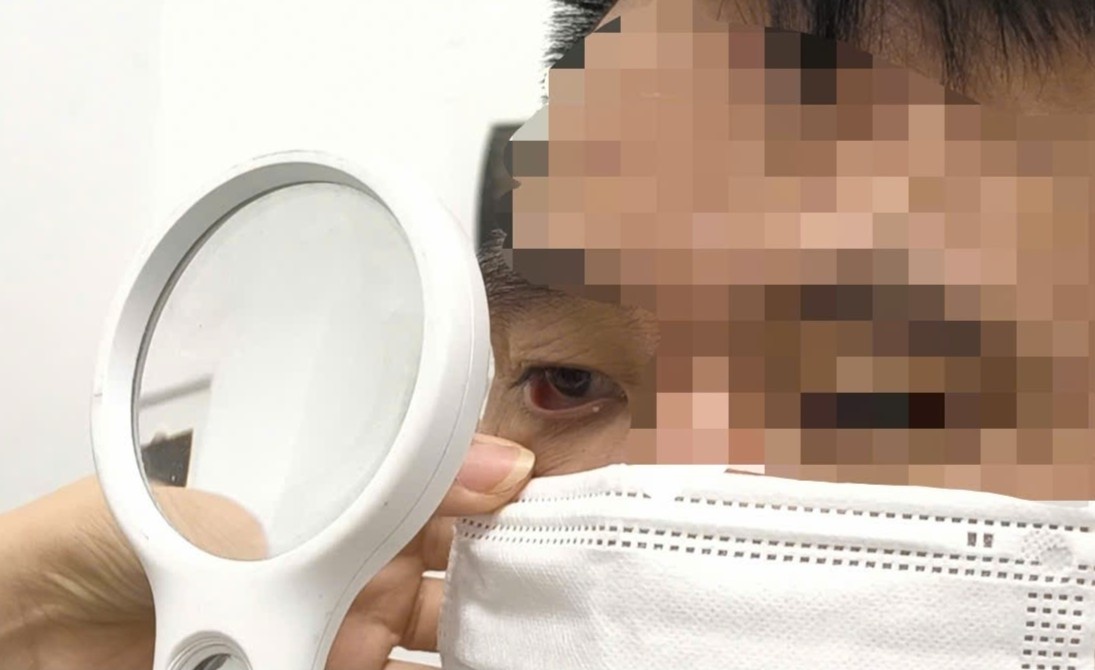 Ngua vung sinh duc du doi suot 1 nam, ket qua soi da khien bac si soc hinh anh