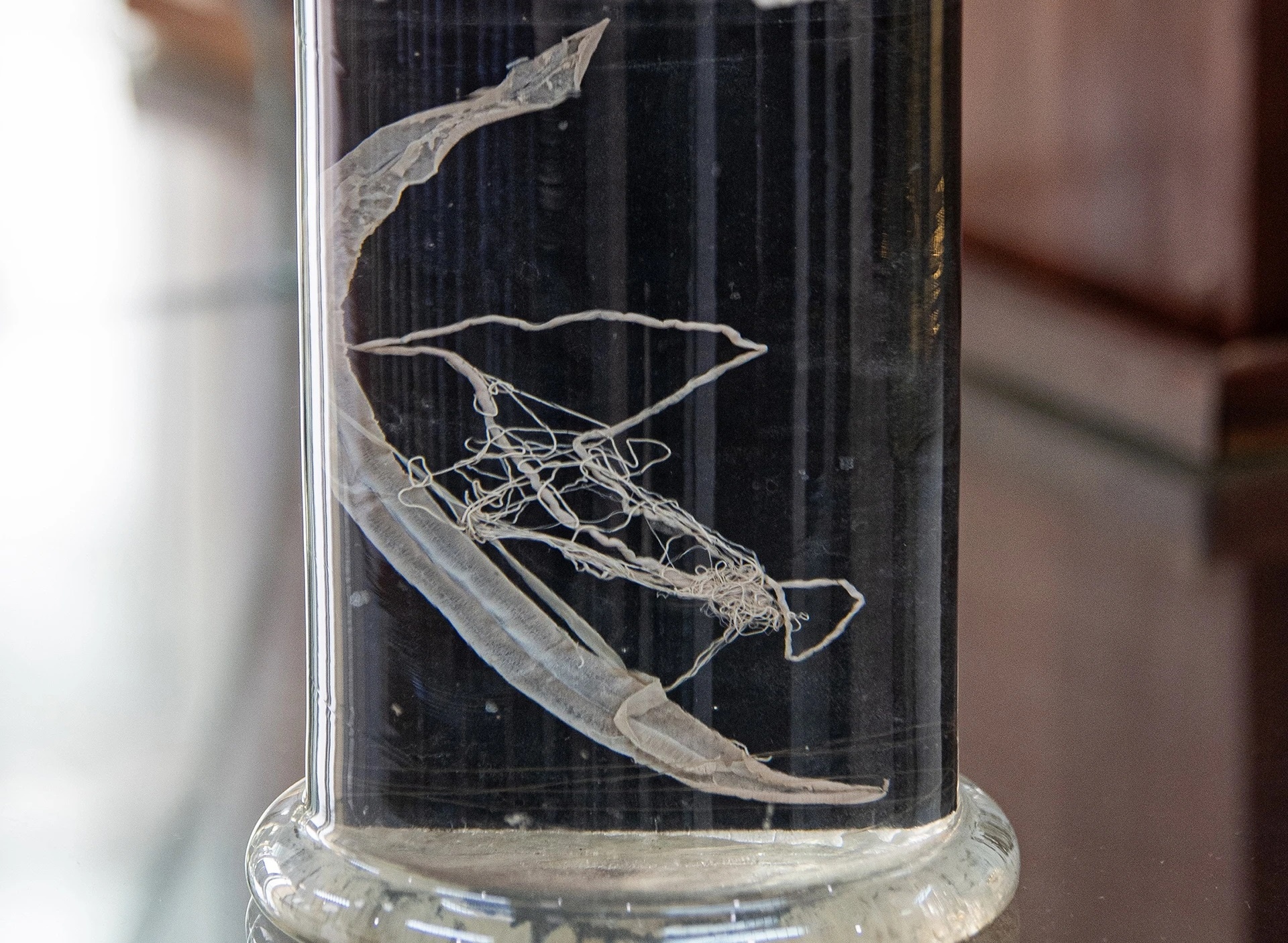 'Sat thu' an nap trong co the, am tham pha hoai gan, nao hinh anh