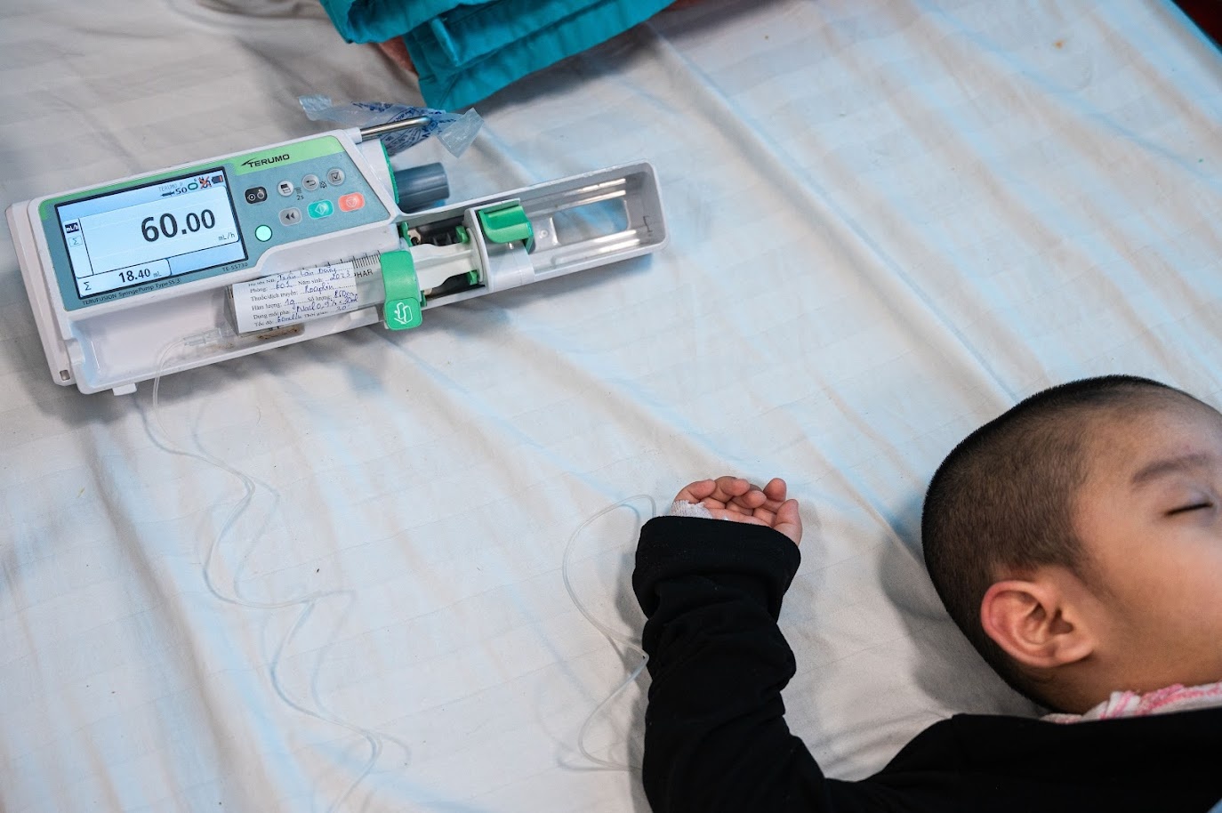 Tiep nhan ca benh rat hiem, bac si BV Nhi TW chi ra 3 luu y quan trong hinh anh