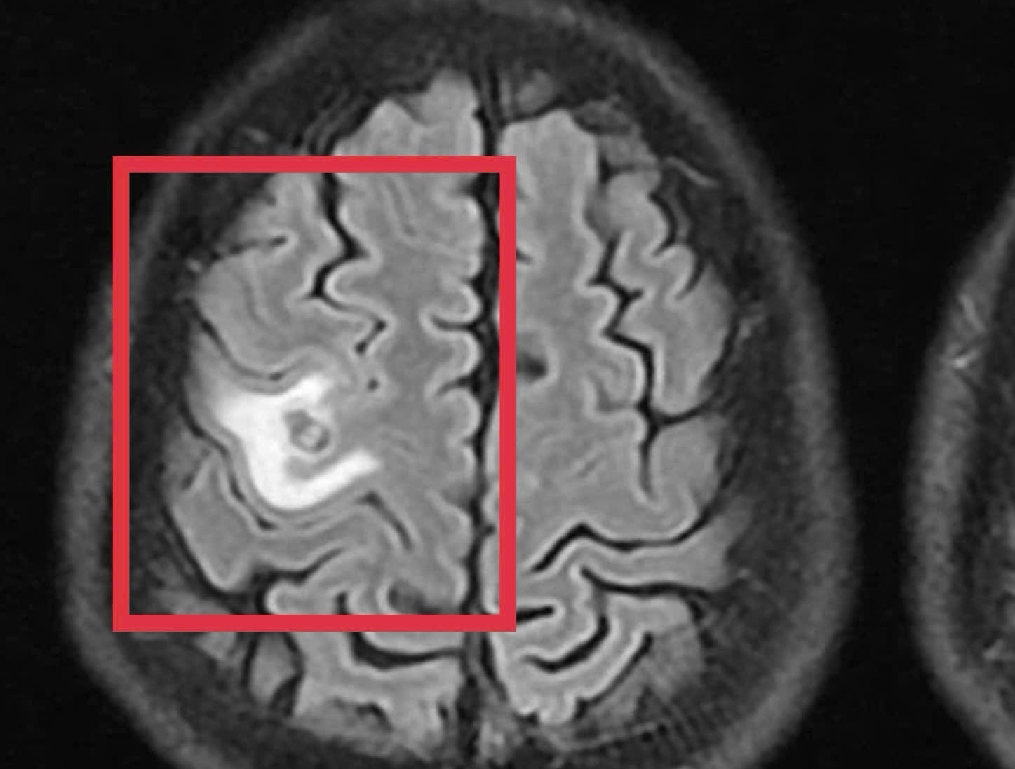 Bac si soc khi phat hien o san trong nao nguoi dan ong hinh anh