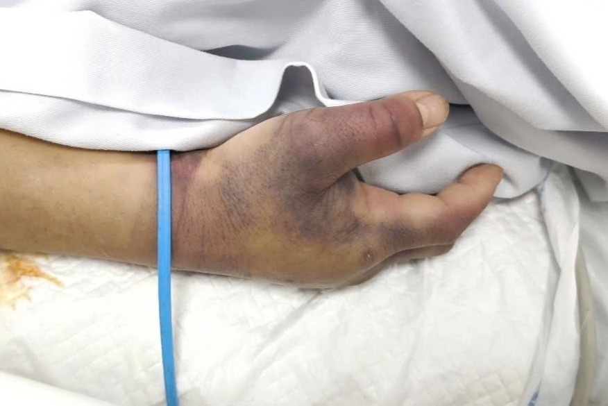 Nguoi dan ong nguy kich vi can benh ai cung chu quan hinh anh