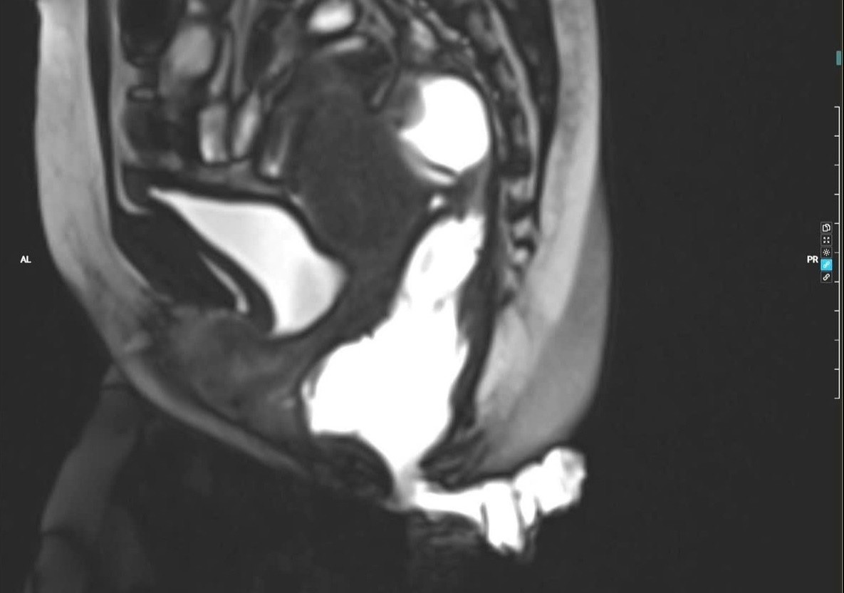 Ganh hau qua nang ne, chiu dau don vi chua tri sai lam hinh anh