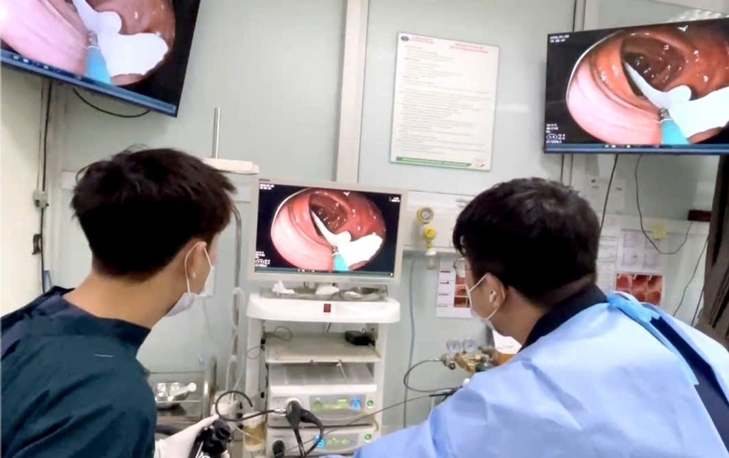 Bac si soc khi noi soi dai trang benh nhan thich an thit bo, heo tai hinh anh