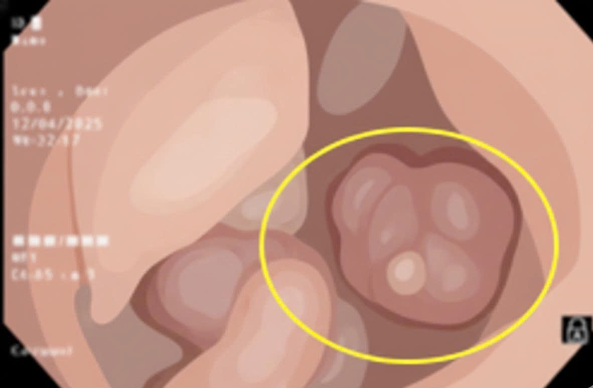 Nguoi dan ong co 3 dau hieu cua benh ung thu nhung khong biet hinh anh