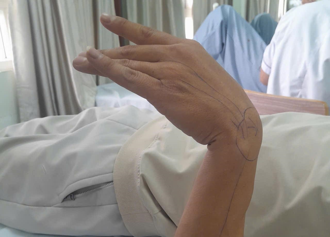 Nguoi dan ong ganh hau qua khong ngo chi sau 30 phut ngu gat hinh anh