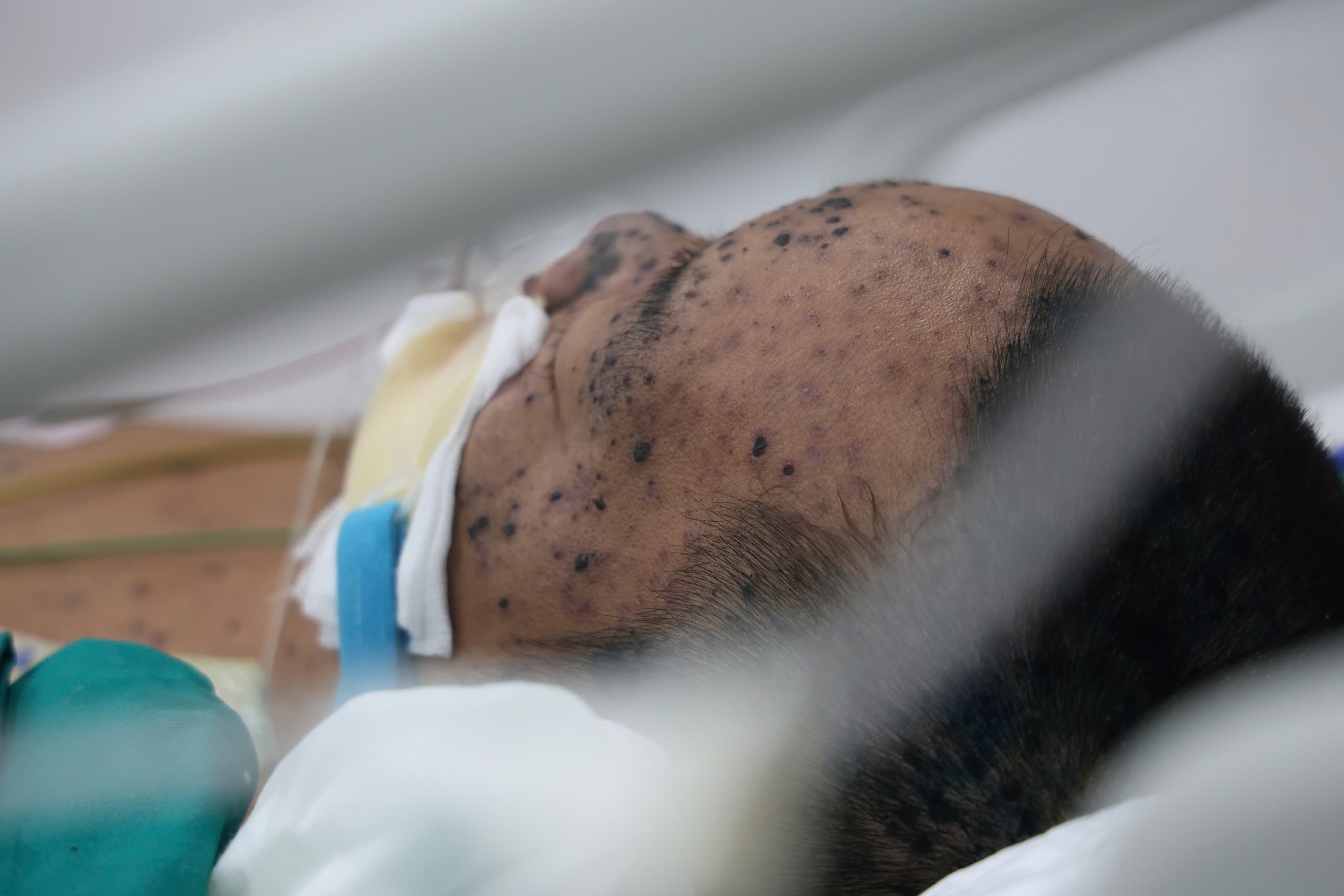 Chu quan lay benh tu con, nguoi dan ong 36 tuoi nguy kich hinh anh