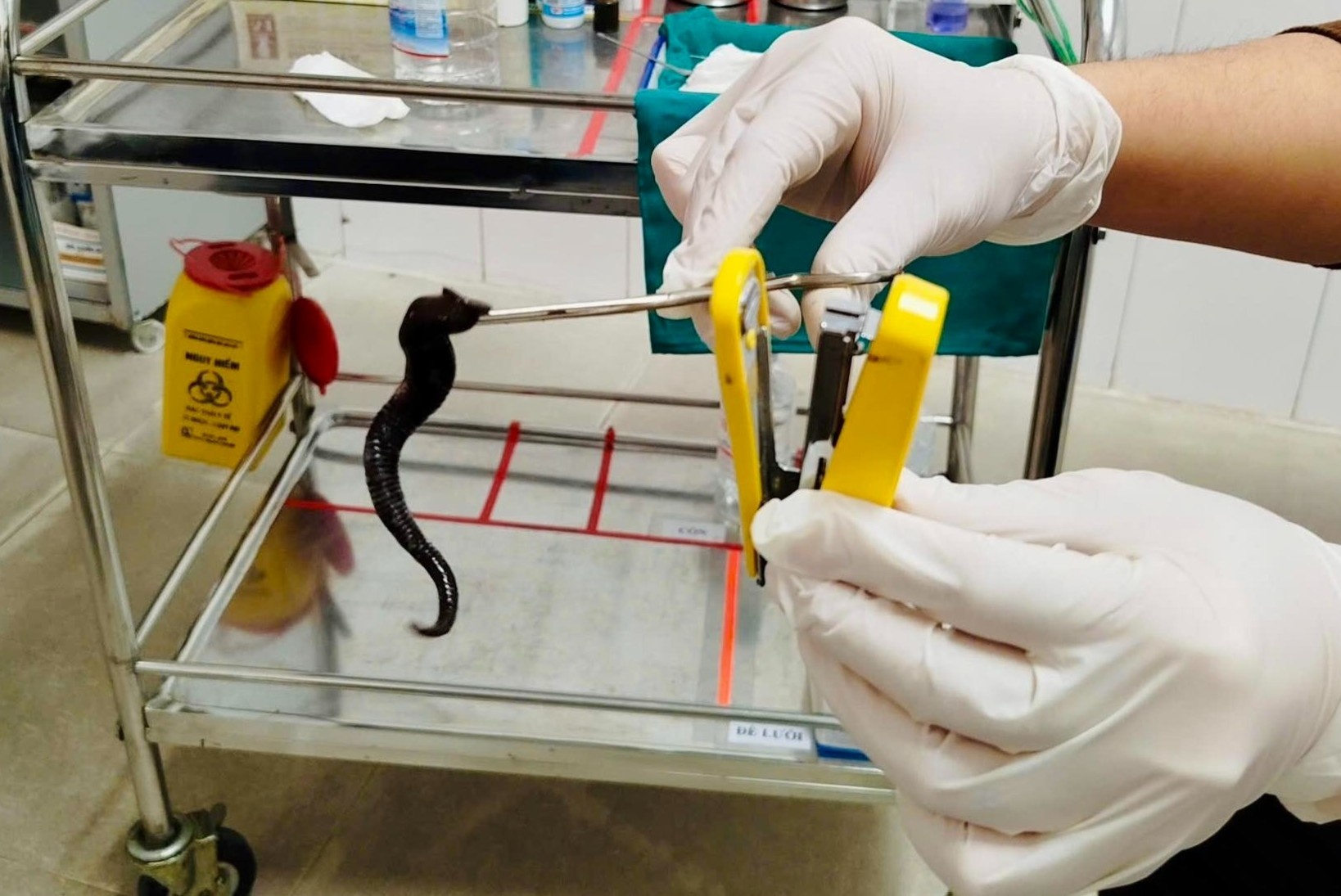 Bac si gap di vat kho tin tu hoc mui nguoi benh hinh anh