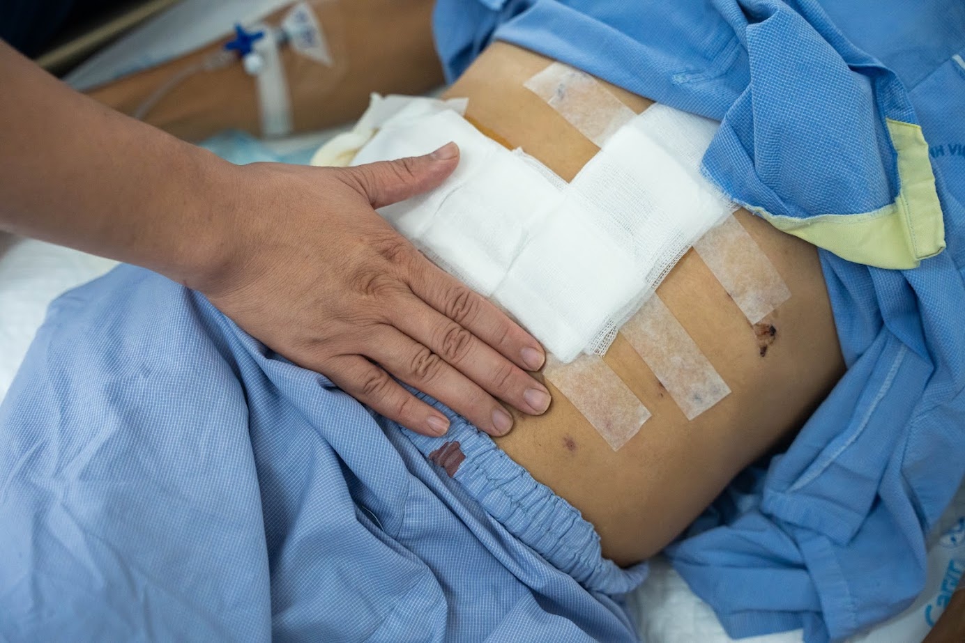 Mot dau hieu canh bao som benh gan mat khong nen bo qua hinh anh