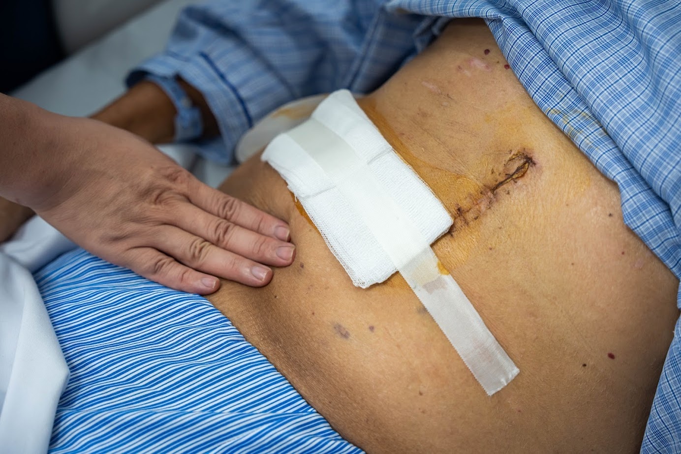 Tu hai trieu chung lap lai, nguoi dan ong phat hien ung thu gan hinh anh