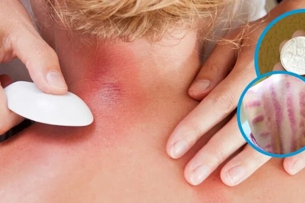 Vi sao dau moi nguoi, 'trung gio' dung do bac, trung ga de cao gio? hinh anh