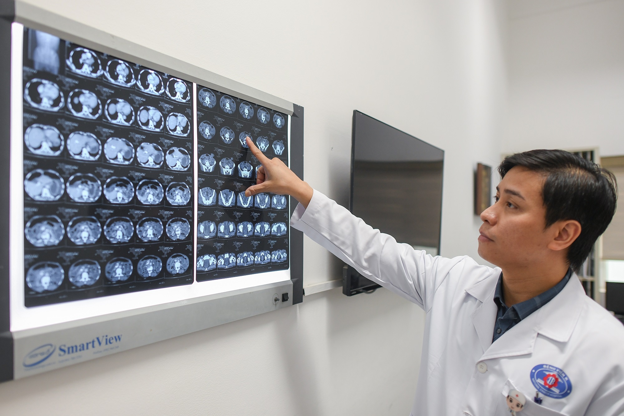 Chup X-quang 6 phut moi duoc BHYT chi tra: Gia thuc te ra sao? hinh anh