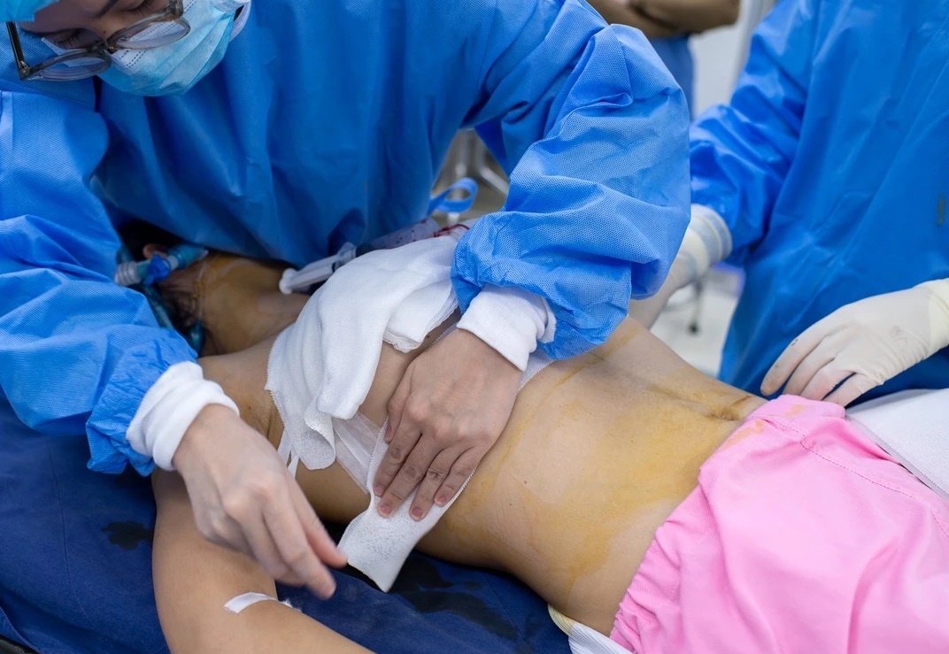 Can Tet di tham my: Dieu bac si muon ban biet hinh anh