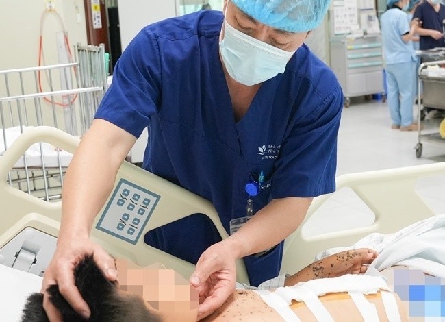 Sau tieng no lon, be trai bi gam nhieu manh vo sac nhon khap co the hinh anh