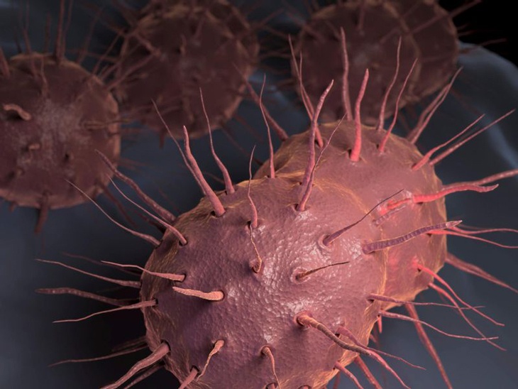 Dau hieu nhan biet benh lau o nam gioi hinh anh