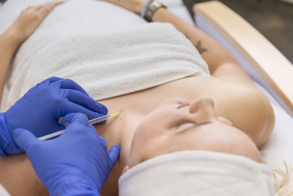 Hai vung tuyet doi khong nen tiem filler hinh anh