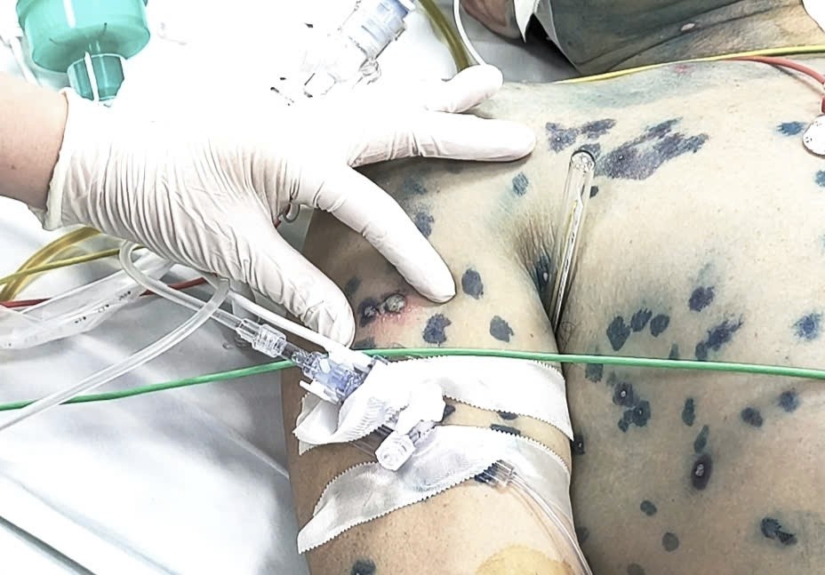 He mien dich 'vo tran', nguoi dan ong 39 tuoi roi vao cua tu hinh anh