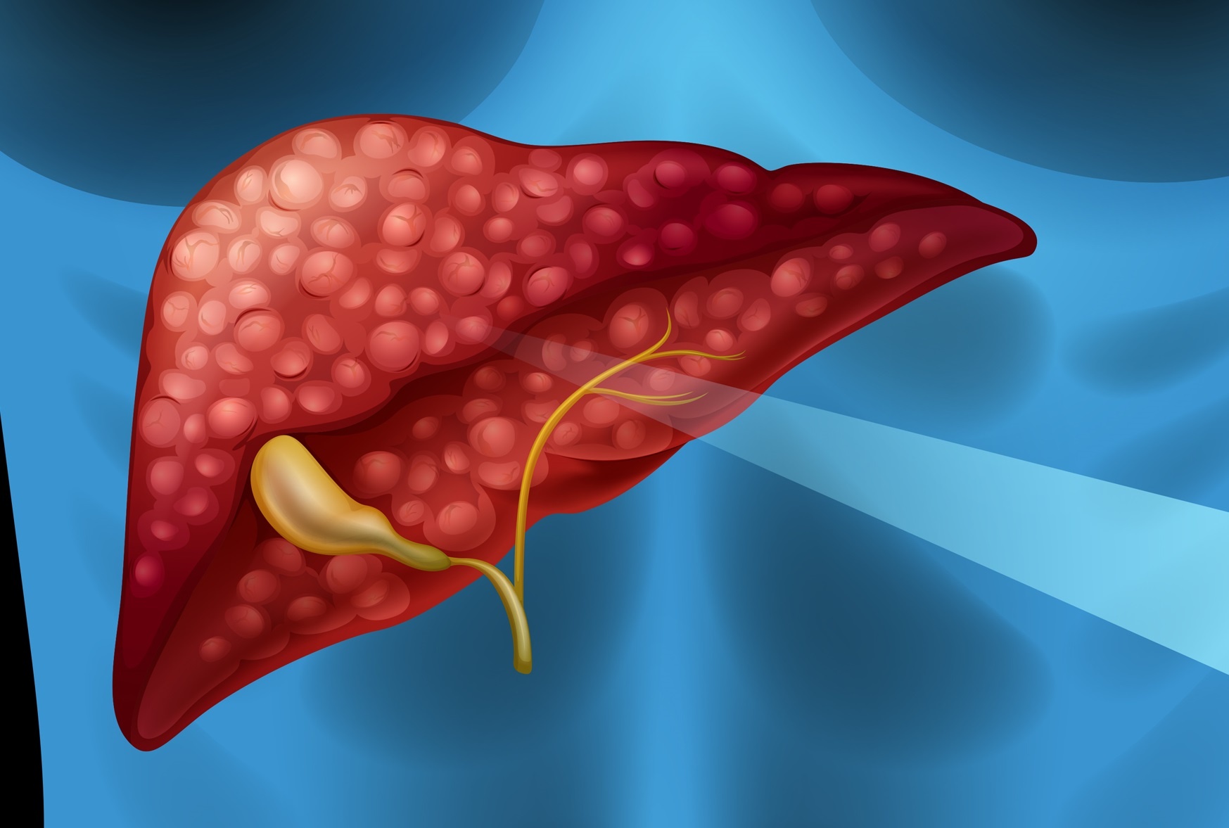 Can benh co the 'pha gan' ma khong canh bao hinh anh