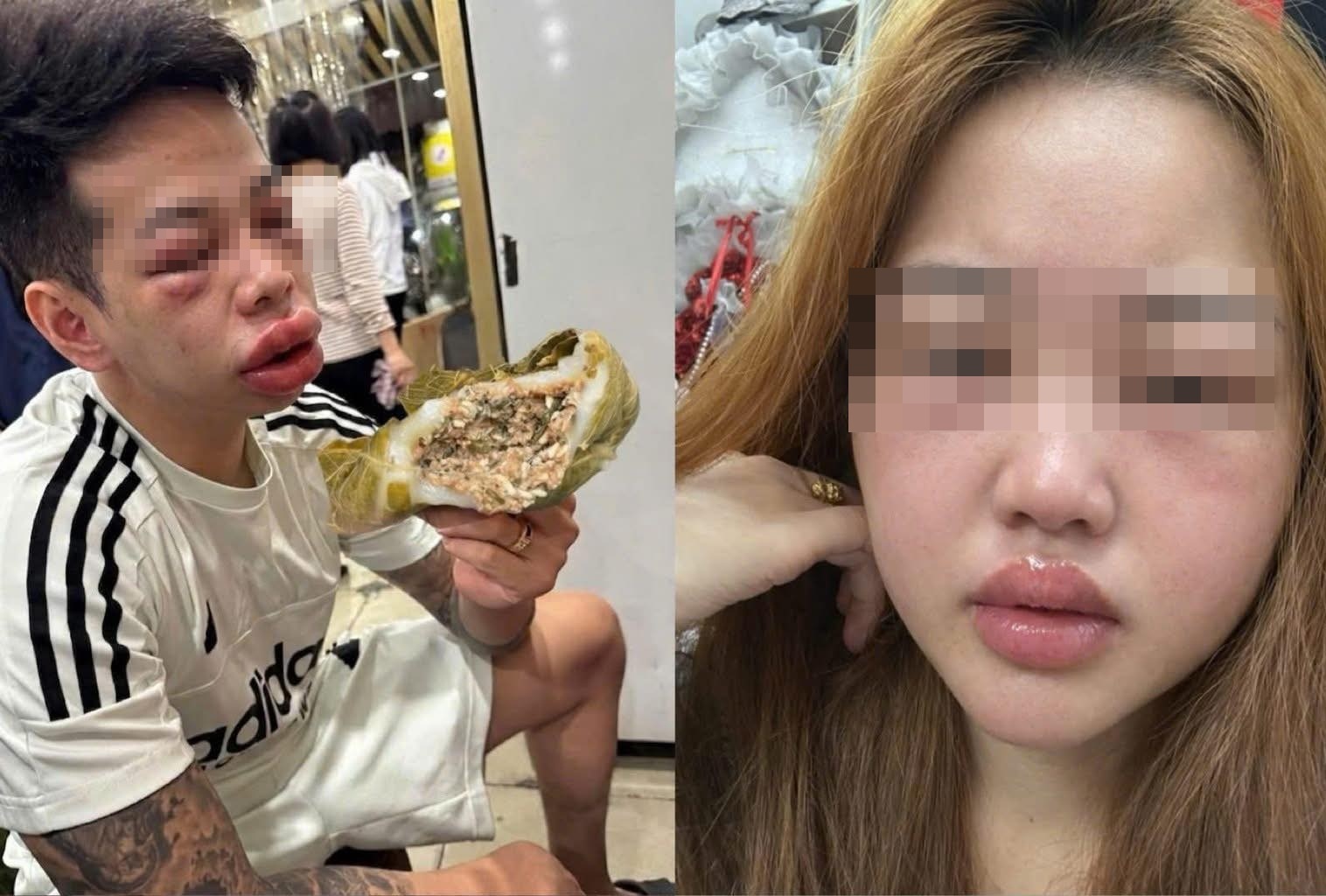 Vi sao mat nhieu nguoi sung vu, mat hip tit sau an banh trung kien? hinh anh