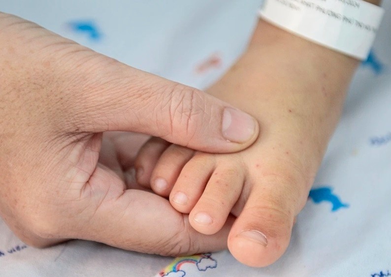 Don dap ca tay chan mieng nhap vien, bac si canh bao virus EV71 hinh anh