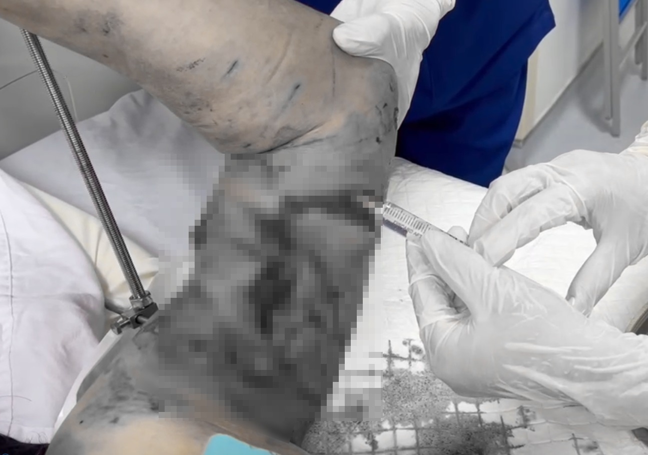 Nhap vien trong tinh trang thuong tam vi bi cho becgie can xe hinh anh