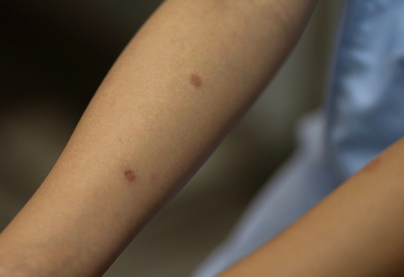 Mot sai lam khi ngua khien be gai 14 tuoi kho so hinh anh