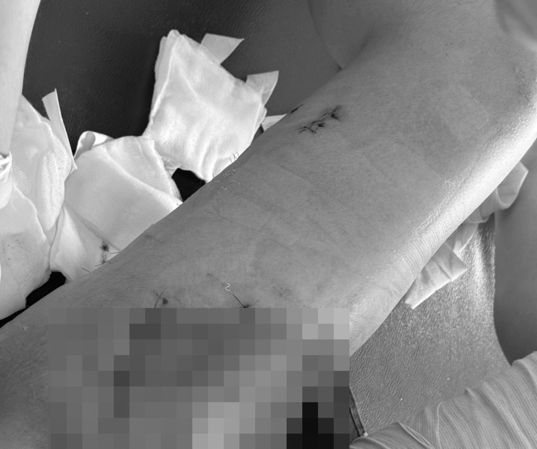 Cuu co gai 25 tuoi bi xe tai 10 tan keo le hinh anh