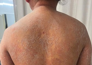 Bac si soc khi benh nhan den kham voi co the phu kin nam hinh anh