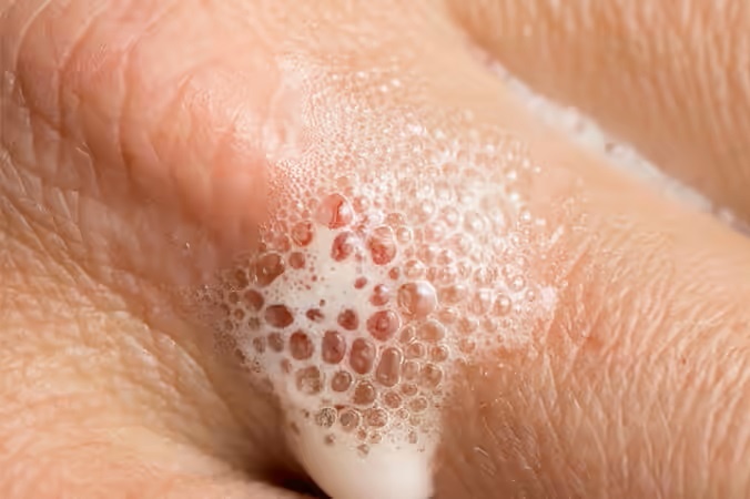 Oxy gia bi quay lung hinh anh