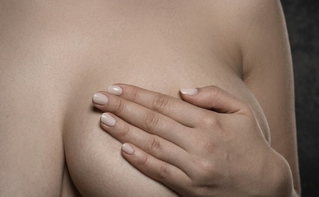 Co gai 26 tuoi nhap vien voi vung nguc bi bien dang hinh anh