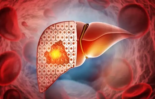 Khi 'thuoc bo' hoa doc duoc: Sai lam tan pha gan cua nhieu nguoi Viet hinh anh