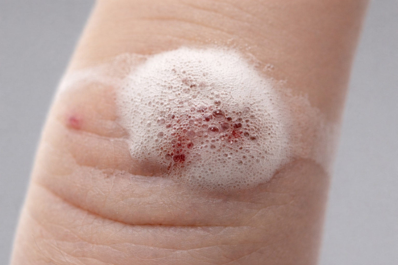 Vi sao oxy gia het thoi? hinh anh