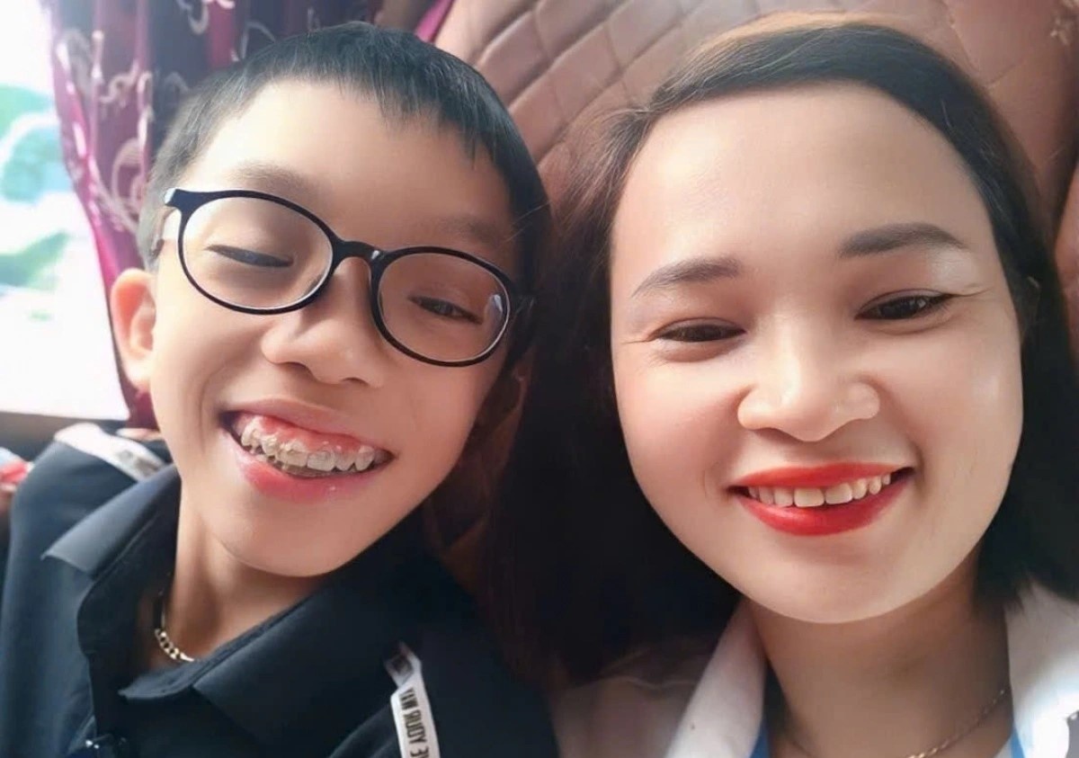 Tre thap be, phat hien som va dieu tri dung huong hinh anh