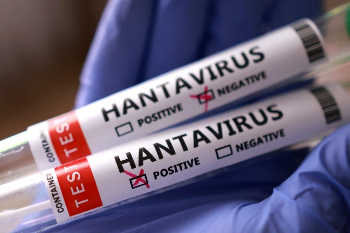 Thong tin cua Bo Y te ve chum ca nhiem virus Hanta hinh anh
