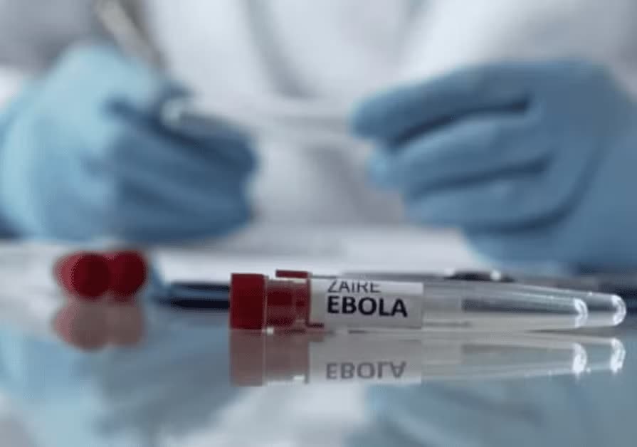 Bo Y te hoa toc yeu cau phong chong dich Ebola hinh anh