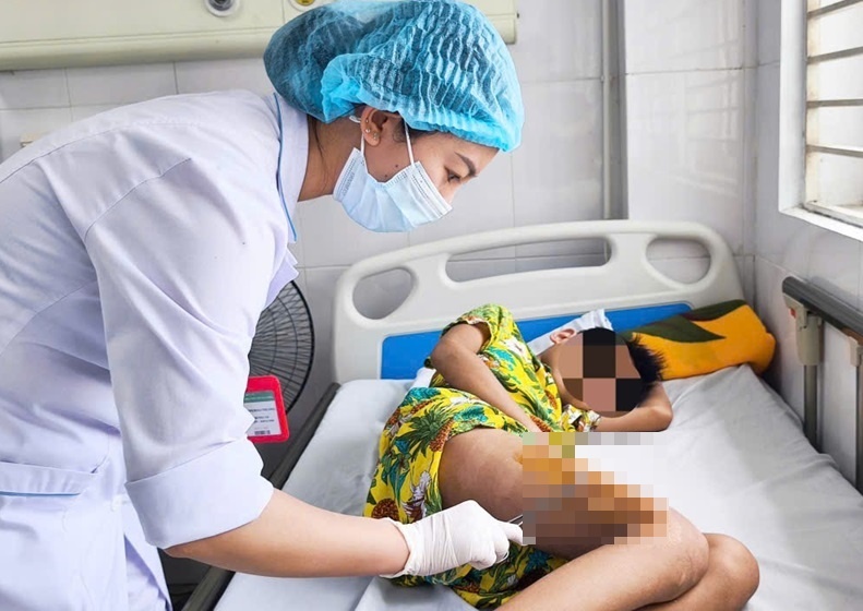 Bao nhiem trung an sau vao xuong khien be trai suyt tan phe hinh anh