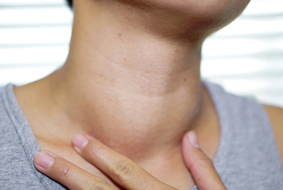 Loại ung thư nhiều người mắc, bác sĩ chỉ ra 5 nhóm nguy cơ cao nhất