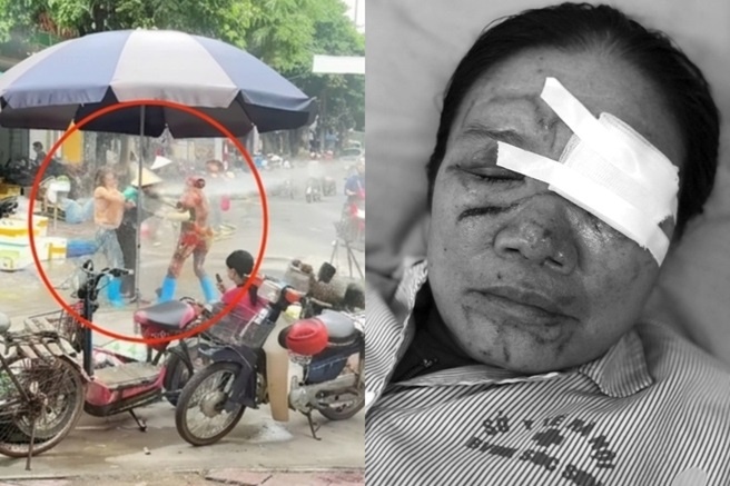 Tinh trang cua nguoi phu nu bi chu quan hai san xit nuoc chay mau mat hinh anh