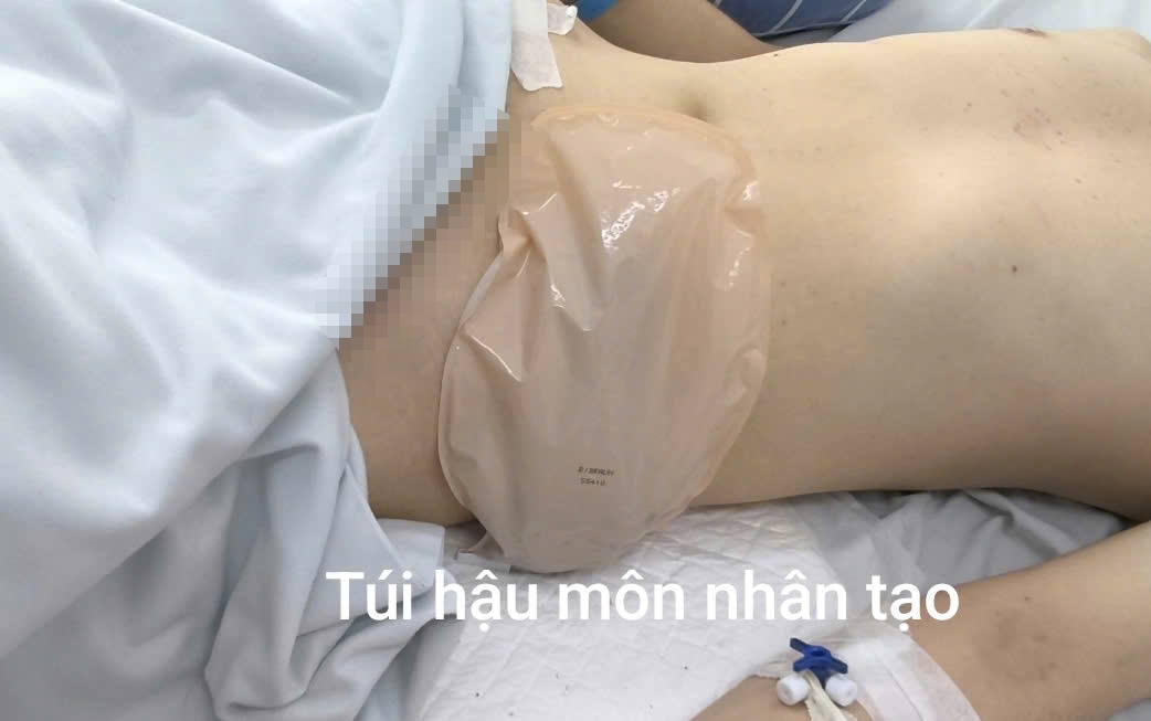 Thanh nien anh 1