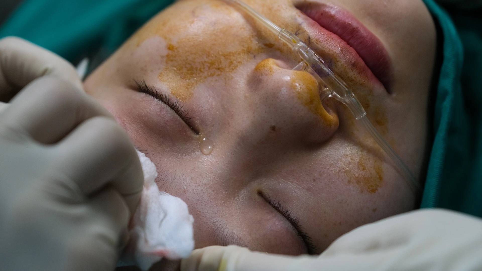 bệnh bạch biết ảnh 8