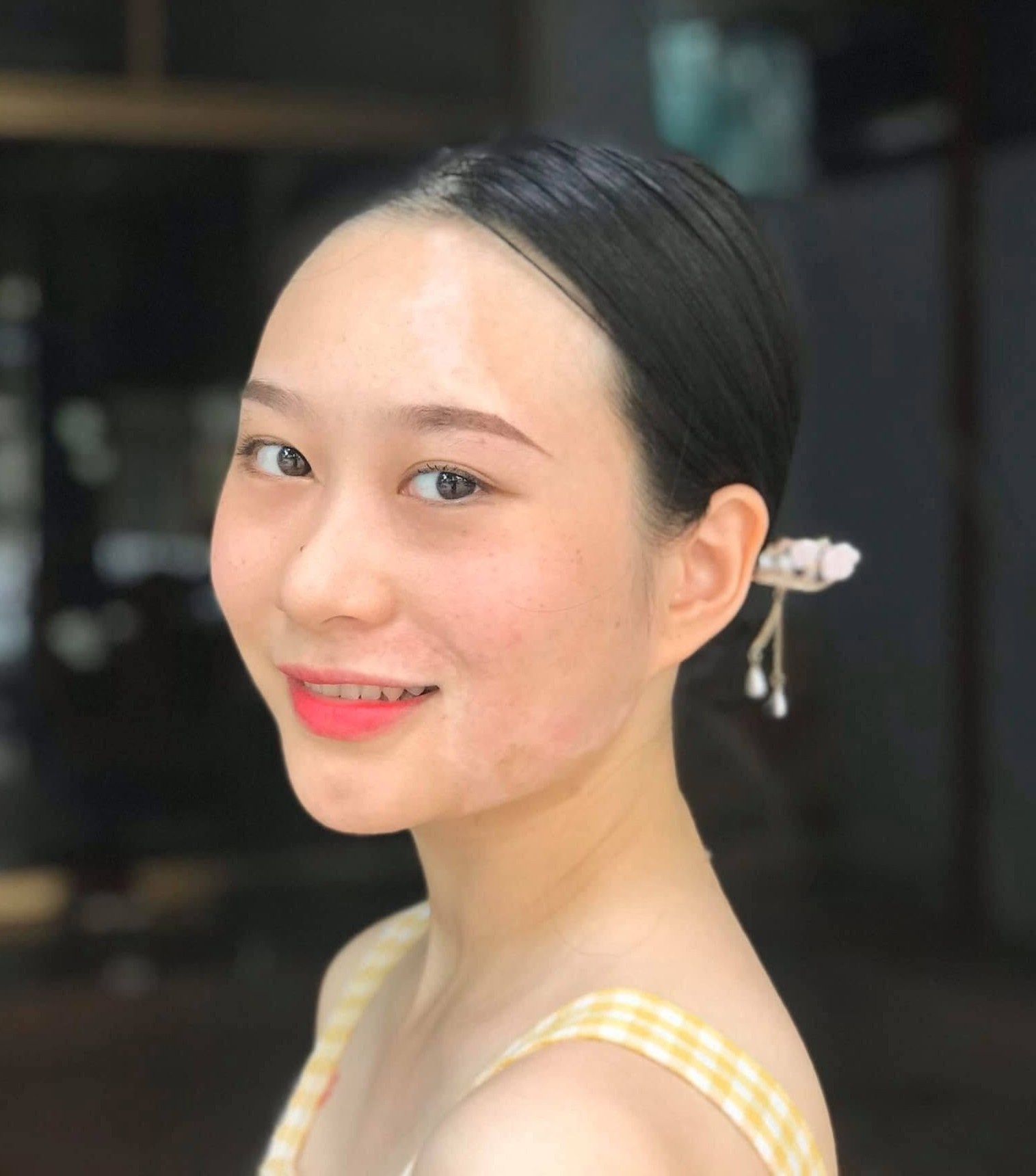 bệnh bạch biết ảnh 6