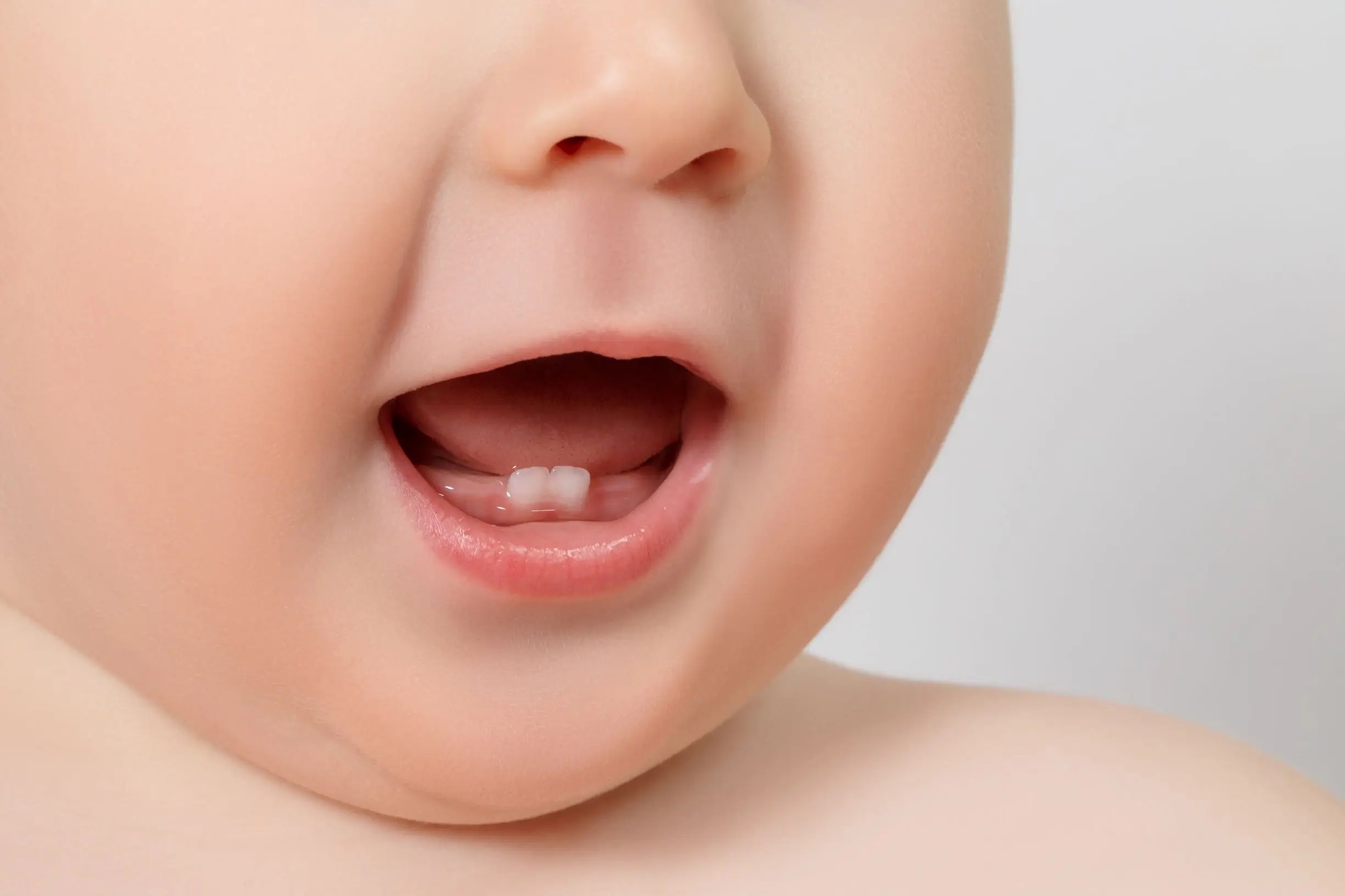 Dính thắng lưỡi ở trẻ em