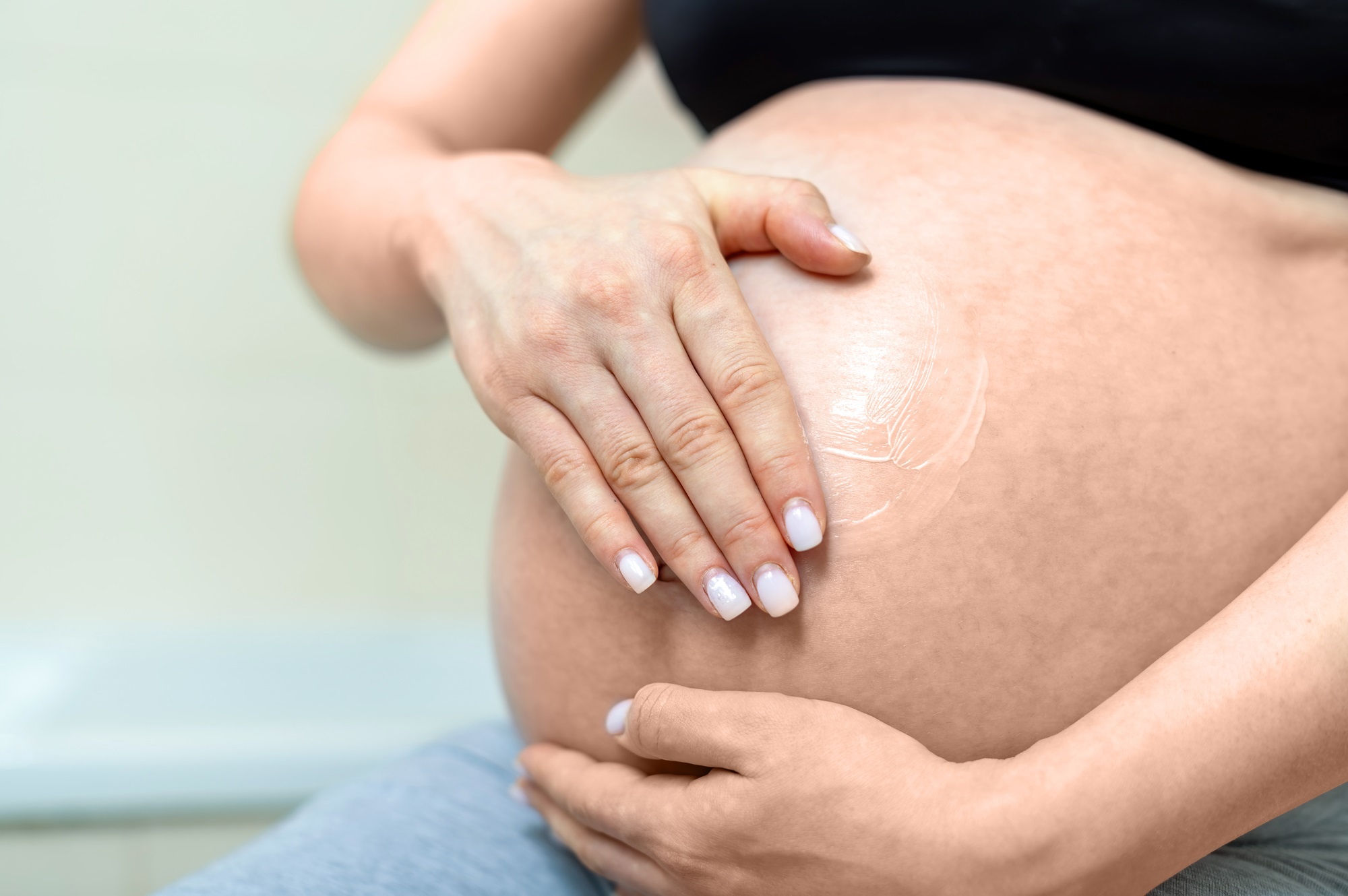 Bác sĩ chỉ 3 cách giúp mẹ bầu giảm nguy cơ rạn da