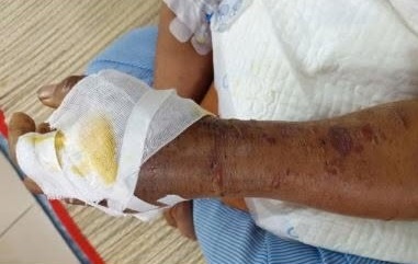 độc tố ảnh 1