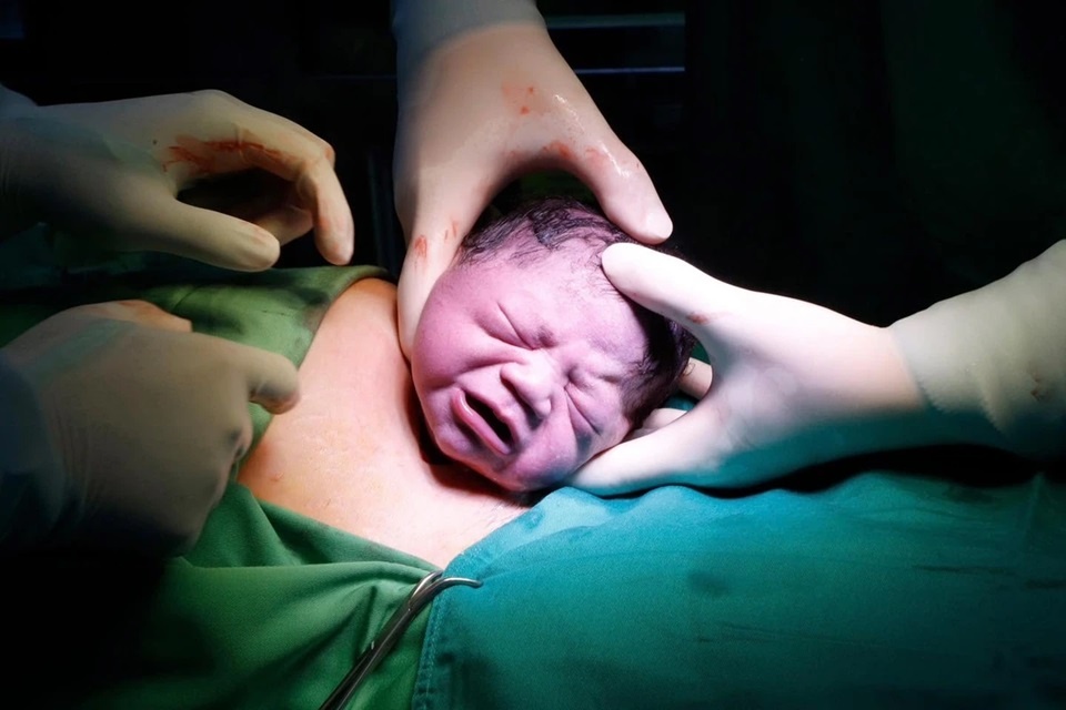 Những lưu ý khi sinh mổ lần hai
